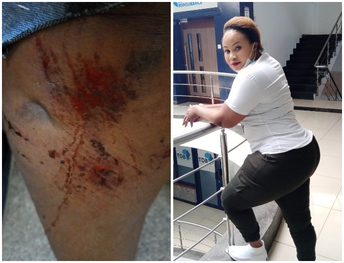 Vitimbi Actress Nyasuguta Beaten Silly By Ruthless Uber Driver 
