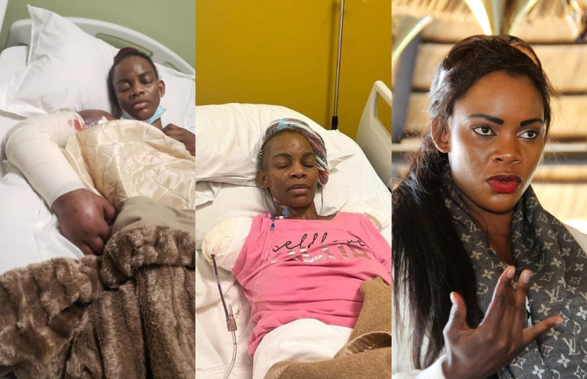 Former Beauty Queen Marry Mubaiwa Threatens To Commit Suicide Weeks After Her Arm Is Amputated
